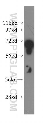 STXBP1 Antibody in Western Blot (WB)