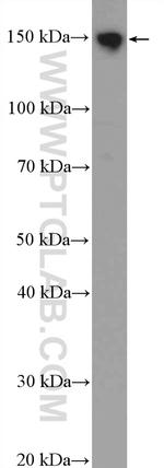 SKIV2L Antibody in Western Blot (WB)