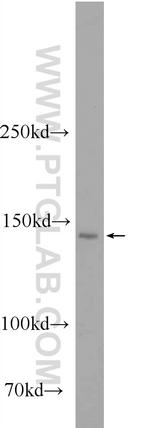 SKIV2L Antibody in Western Blot (WB)