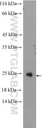 RAX2 Antibody in Western Blot (WB)