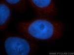 ADRM1 Antibody in Immunocytochemistry (ICC/IF)