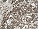 ADRM1 Antibody in Immunohistochemistry (Paraffin) (IHC (P))