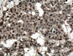 ADRM1 Antibody in Immunohistochemistry (Paraffin) (IHC (P))