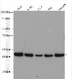 ADRM1 Antibody in Western Blot (WB)