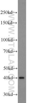 ADRM1 Antibody in Western Blot (WB)