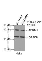 ADRM1 Antibody in Western Blot (WB)