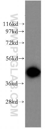 ADRM1 Antibody in Western Blot (WB)