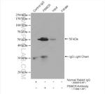 PSMD5 Antibody in Immunoprecipitation (IP)