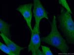 MTAP Antibody in Immunocytochemistry (ICC/IF)