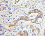 MTAP Antibody in Immunohistochemistry (Paraffin) (IHC (P))