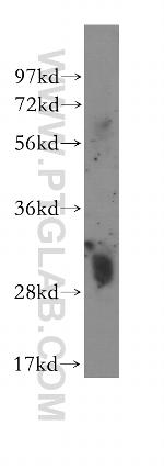 MTAP Antibody in Western Blot (WB)