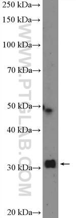 MTAP Antibody in Western Blot (WB)