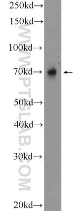 TRIM5 Antibody in Western Blot (WB)