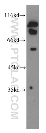 AGS3 Antibody in Western Blot (WB)