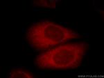 AGS3 Antibody in Immunocytochemistry (ICC/IF)