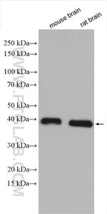 SCN1B Antibody in Western Blot (WB)