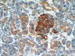 APOL1 Antibody in Immunohistochemistry (Paraffin) (IHC (P))