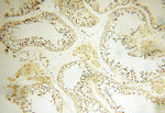 APOL1 Antibody in Immunohistochemistry (Paraffin) (IHC (P))