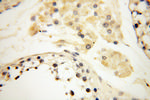 APOL1 Antibody in Immunohistochemistry (Paraffin) (IHC (P))