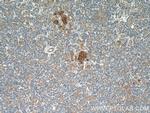 APOL1 Antibody in Immunohistochemistry (Paraffin) (IHC (P))