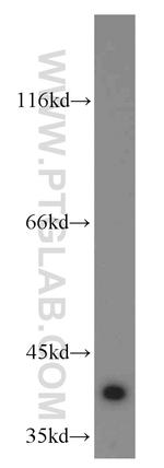 APOL1 Antibody in Western Blot (WB)