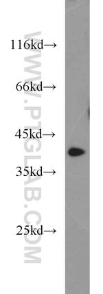 APOL1 Antibody in Western Blot (WB)