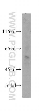 SCMH1 Antibody in Western Blot (WB)