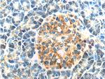 CAPS1 Antibody in Immunohistochemistry (Paraffin) (IHC (P))