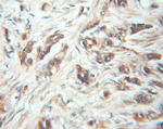 FRS2 Antibody in Immunohistochemistry (Paraffin) (IHC (P))