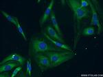 BubR1 Antibody in Immunocytochemistry (ICC/IF)