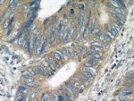 BubR1 Antibody in Immunohistochemistry (Paraffin) (IHC (P))