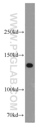 BubR1 Antibody in Western Blot (WB)