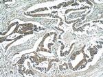 BubR1 Antibody in Immunohistochemistry (Paraffin) (IHC (P))