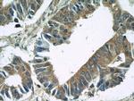 BubR1 Antibody in Immunohistochemistry (Paraffin) (IHC (P))