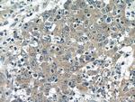 BubR1 Antibody in Immunohistochemistry (Paraffin) (IHC (P))