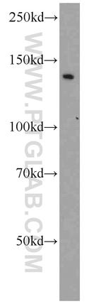 BubR1 Antibody in Western Blot (WB)