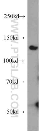 BubR1 Antibody in Western Blot (WB)