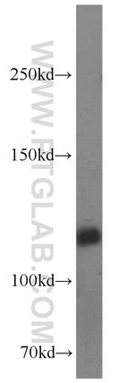 BubR1 Antibody in Western Blot (WB)