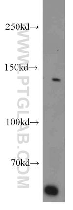 BubR1 Antibody in Western Blot (WB)