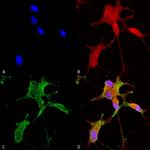 Cav3.2 Ca+2 Channel Antibody in Immunocytochemistry (ICC/IF)