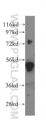 SNX4 Antibody in Western Blot (WB)