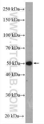 FNTB Antibody in Western Blot (WB)