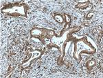 PTP4A1/PRL1 Antibody in Immunohistochemistry (Paraffin) (IHC (P))