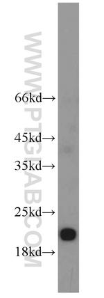 PTP4A1/PRL1 Antibody in Western Blot (WB)