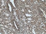 CNN3 Antibody in Immunohistochemistry (Paraffin) (IHC (P))