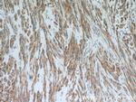 CNN3 Antibody in Immunohistochemistry (Paraffin) (IHC (P))