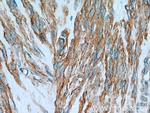 CNN3 Antibody in Immunohistochemistry (Paraffin) (IHC (P))