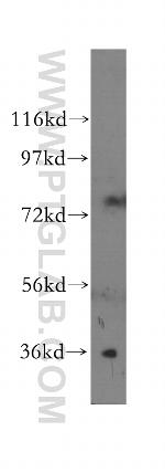 CNN3 Antibody in Western Blot (WB)