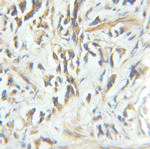 CNN3 Antibody in Immunohistochemistry (Paraffin) (IHC (P))