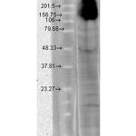 HCN4 Cyclic nucleotide-gated Channel Antibody in Western Blot (WB)